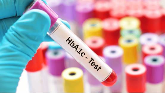 Glikat Hemoglobin (HbA1c) testi nedir?