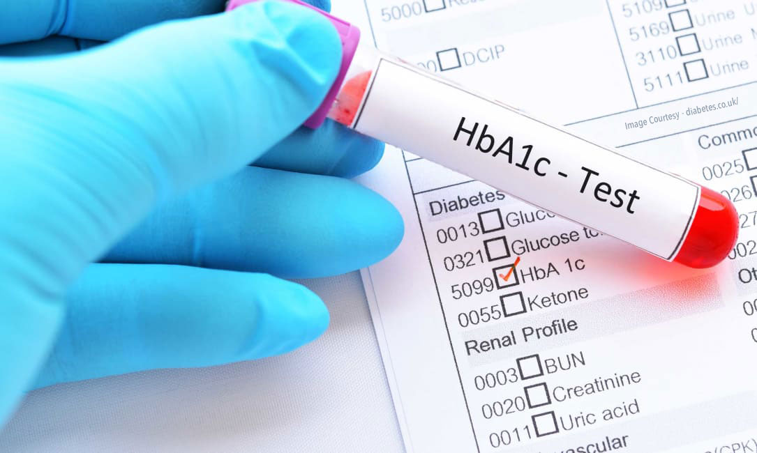 Farklı popülasyonlar için HbA1c Testi